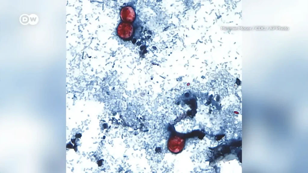 Cyclospora cayetanensis oocysts shown under a microscope in a CDC image used by DW News