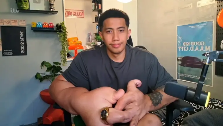 Have You Heard Of The Man With Hands 10 Times Bigger Than Yours?  He’s On Uk’s “This Morning”